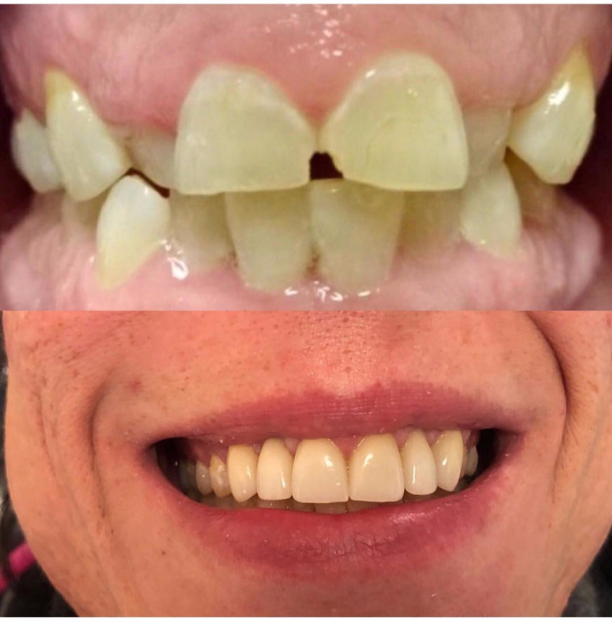 Cosmetic Dentistry